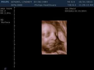 Baby Sam's 3D Sonogram from October 31, 2013