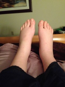 I'm sorry for this morbid photo. But it's my proof that pregnancy gets a little rough sometimes. 